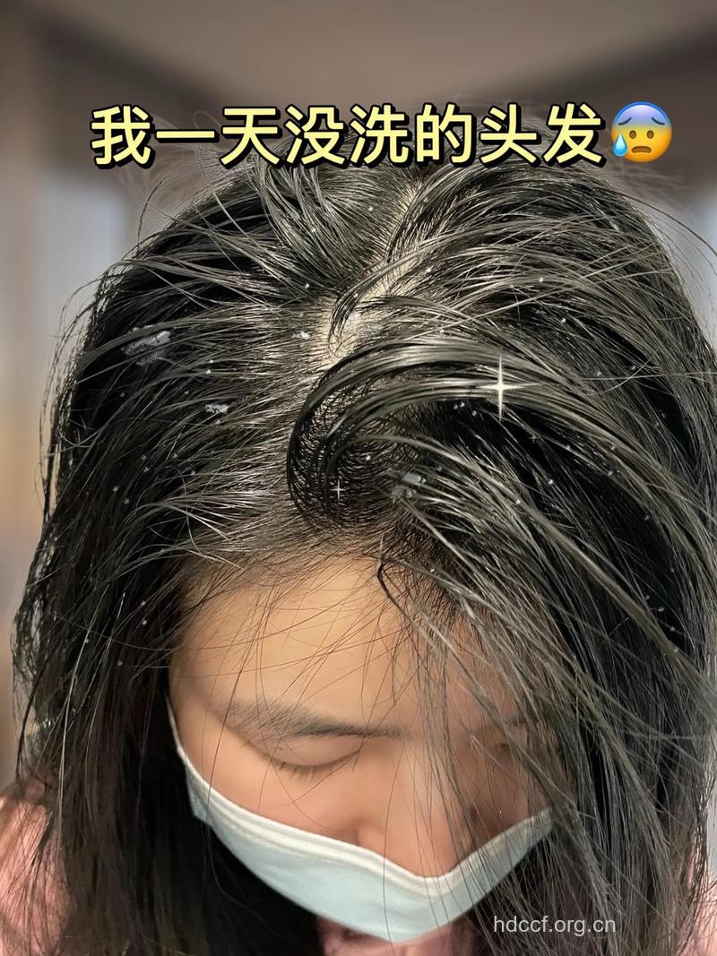 深层清洁洗发水对头发好吗