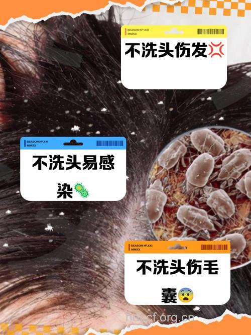 头发不洗为什么会臭?