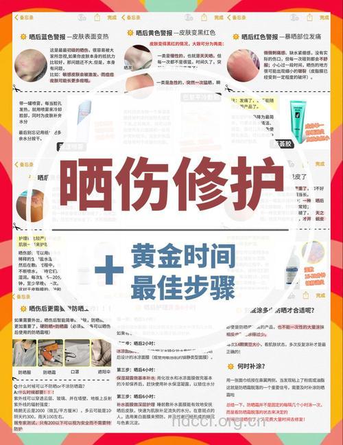 晒伤了怎么办 有哪些急救保养方法