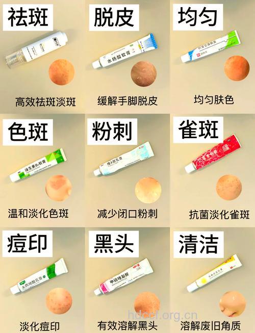 没有快速祛斑之法 选择祛斑产品要慎重