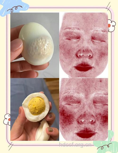 鸡蛋护肤美容方便又有效
