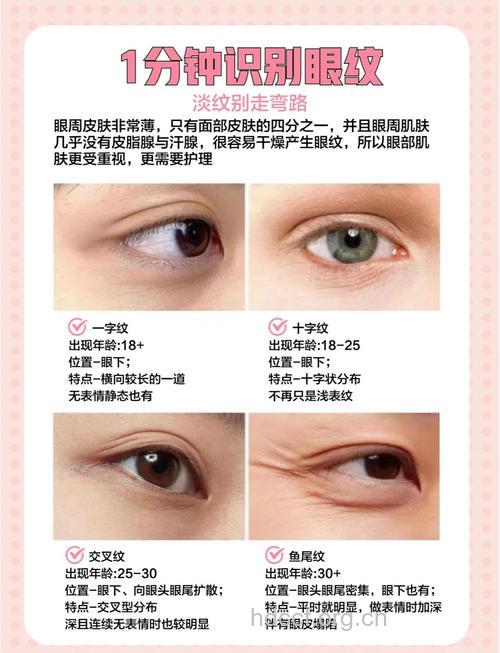 冬天容易出现眼部皱纹 杜绝眼纹有三招