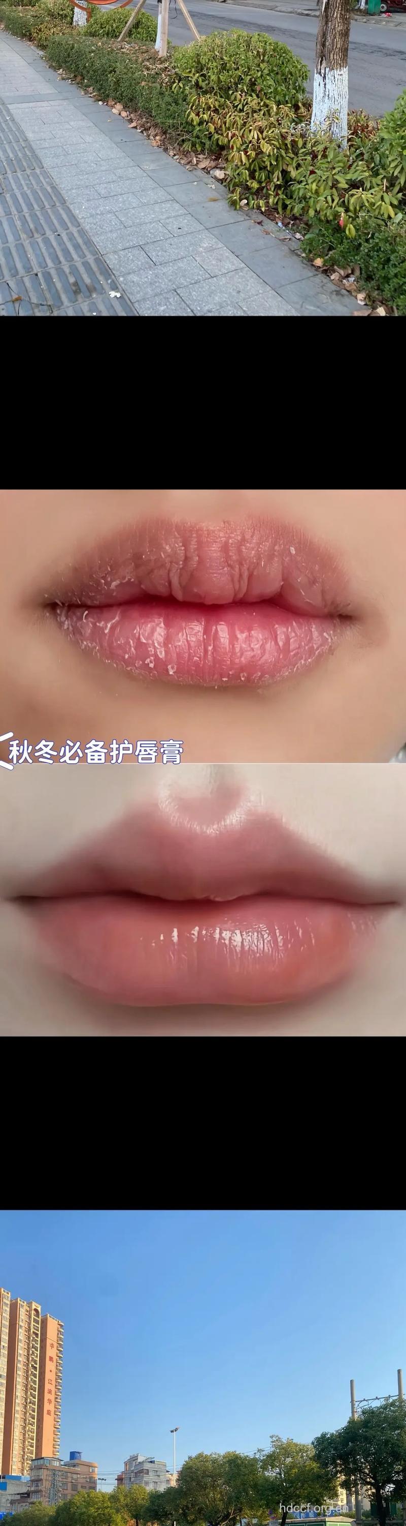 护唇必修课：推荐3款冬季护唇药膳
