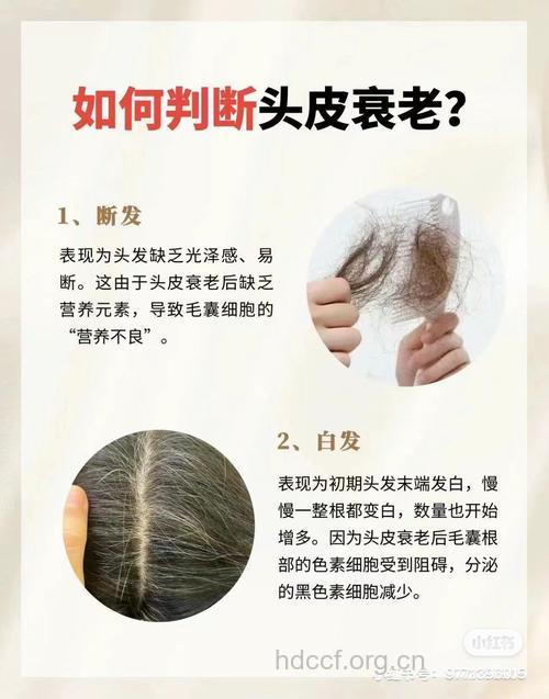 让头发快速衰老的11个原因