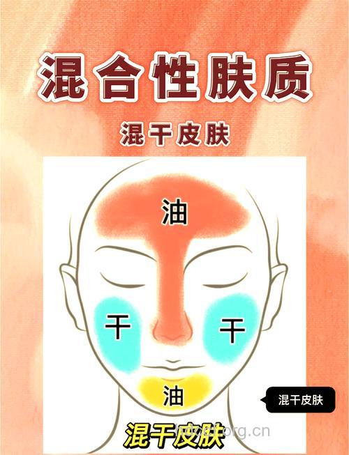 春天混合性肌肤怎么护肤
