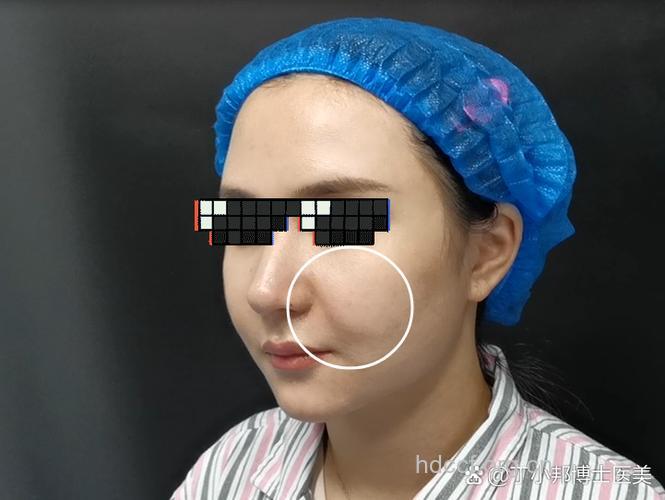 注意表情！法令纹来找你了