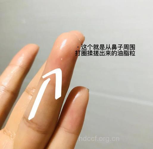 卸妆油可以把黑头搓出来吗