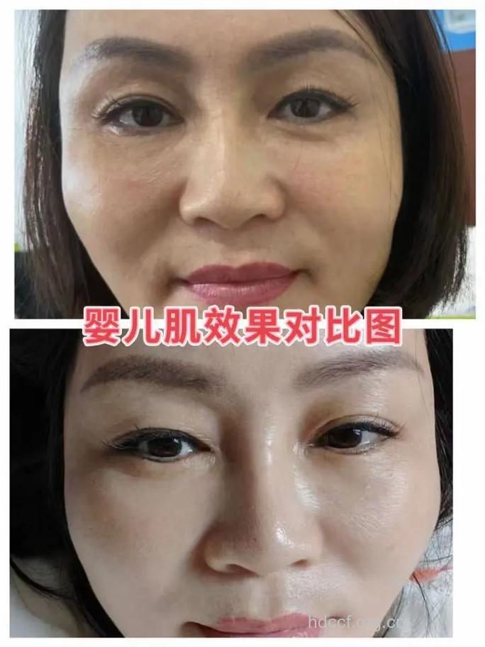 不老秘笈有5步 重获婴儿肌