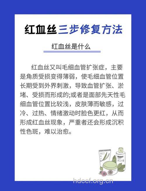 红血丝日常护理方法