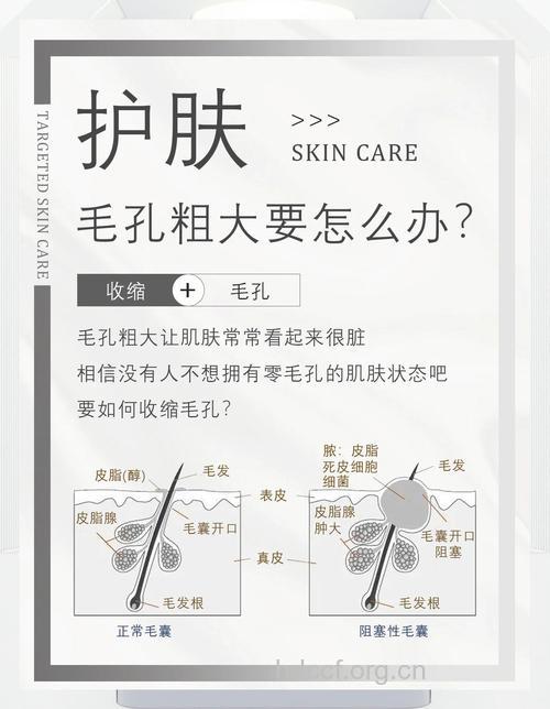 毛孔变粗陷阱多 收缩毛孔有窍门