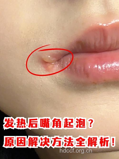 让唇部过个水水的冬季