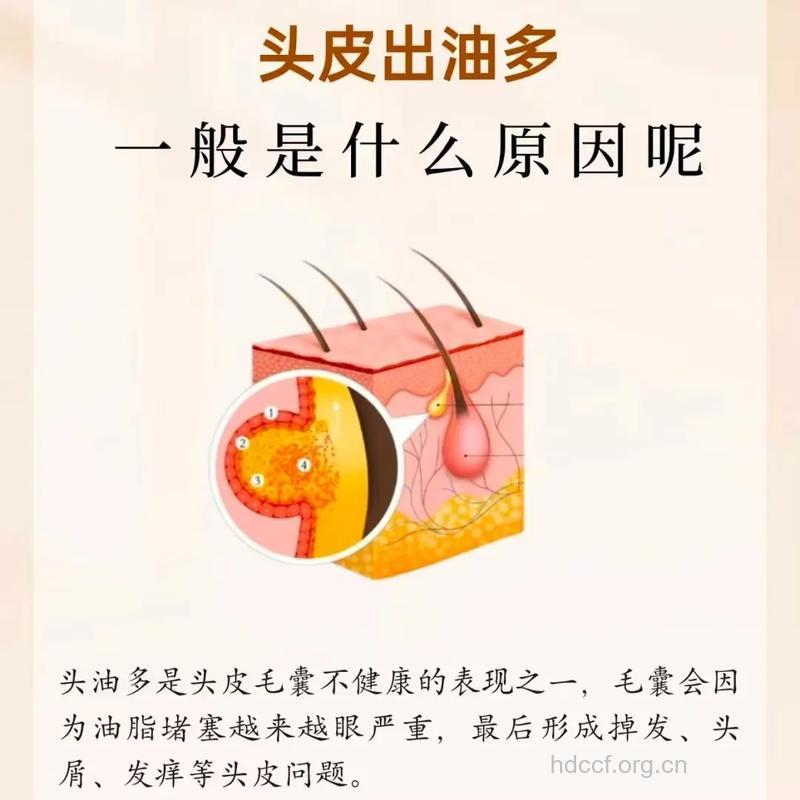 头发出油的各种原因你知道吗