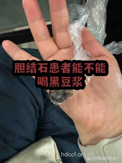 苹果芹菜 7种食物刮走你的赘肉