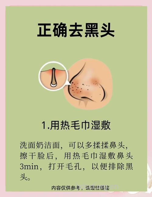 去除黑头要找对窍门