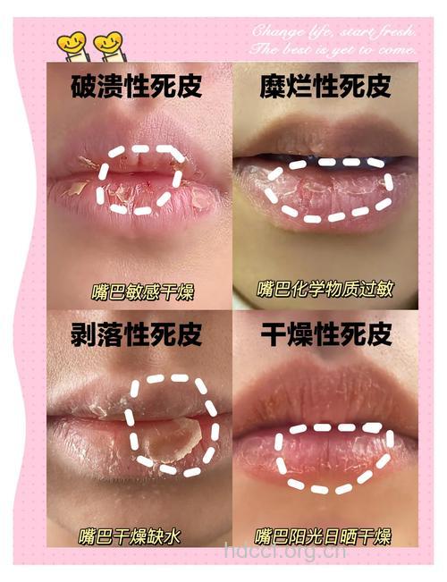 寒冬护唇有绝招 就要唇唇欲动