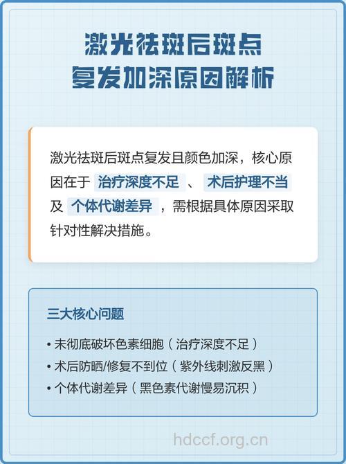激光祛斑后又复发怎么办