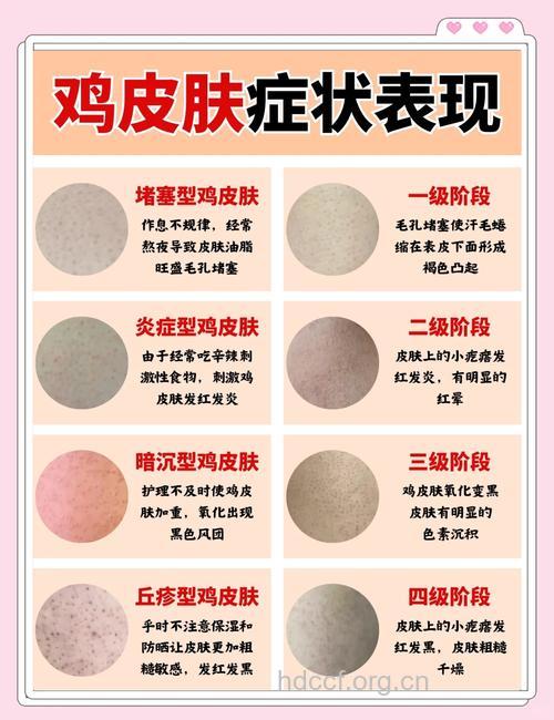 怎么改善鸡皮肤？