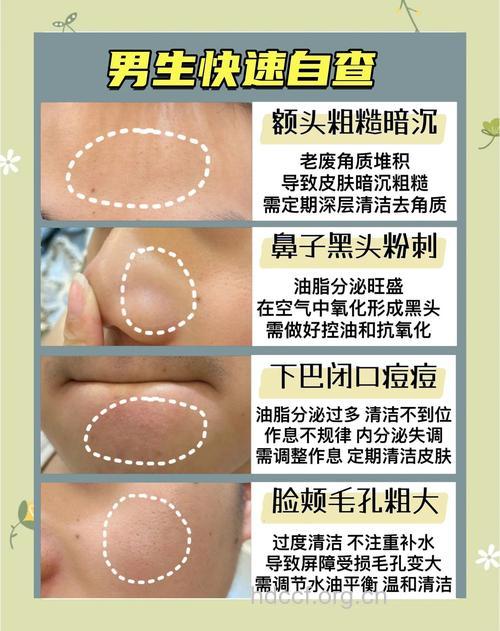 做好这几步和黑头说拜拜