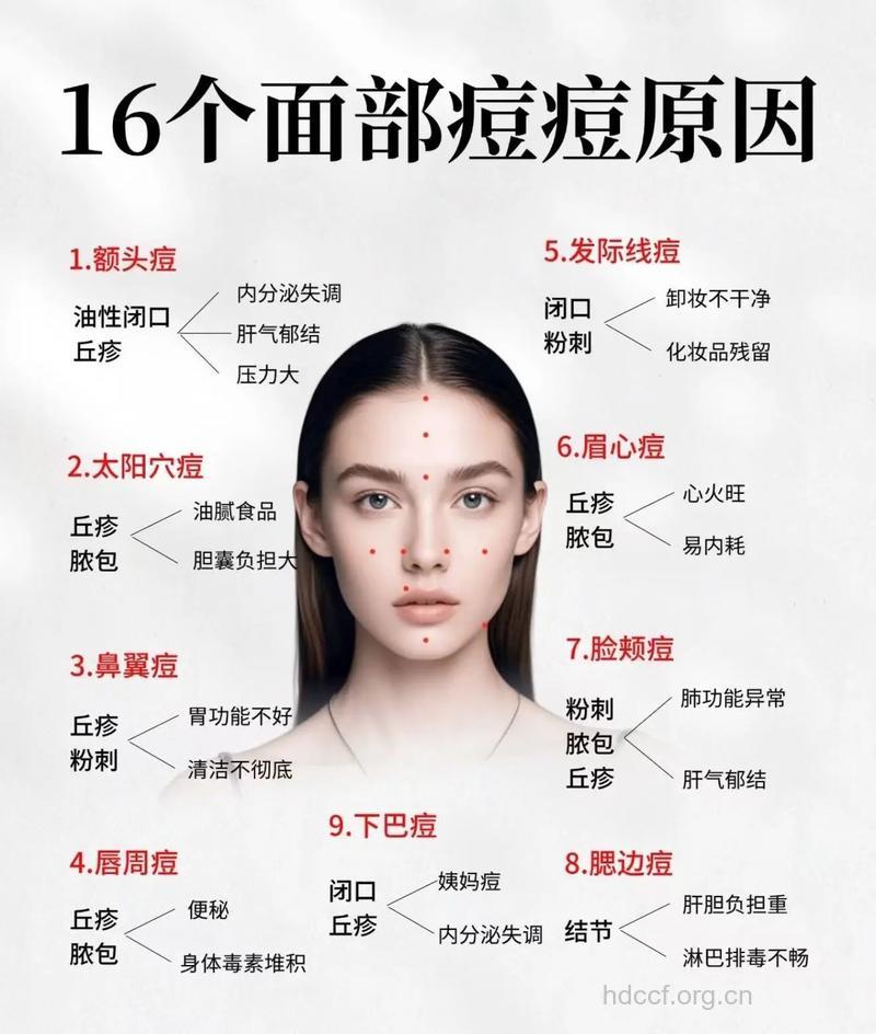 两颊长痘的原因与祛痘方法