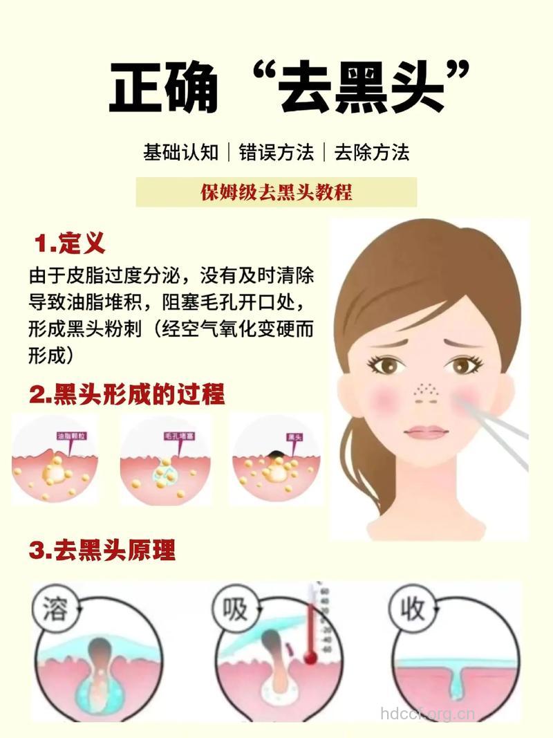 妙方去黑头，让你轻松告别草莓鼻