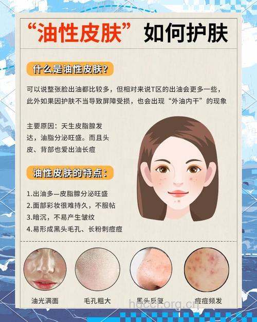 油性皮肤的四大日常护理要诀