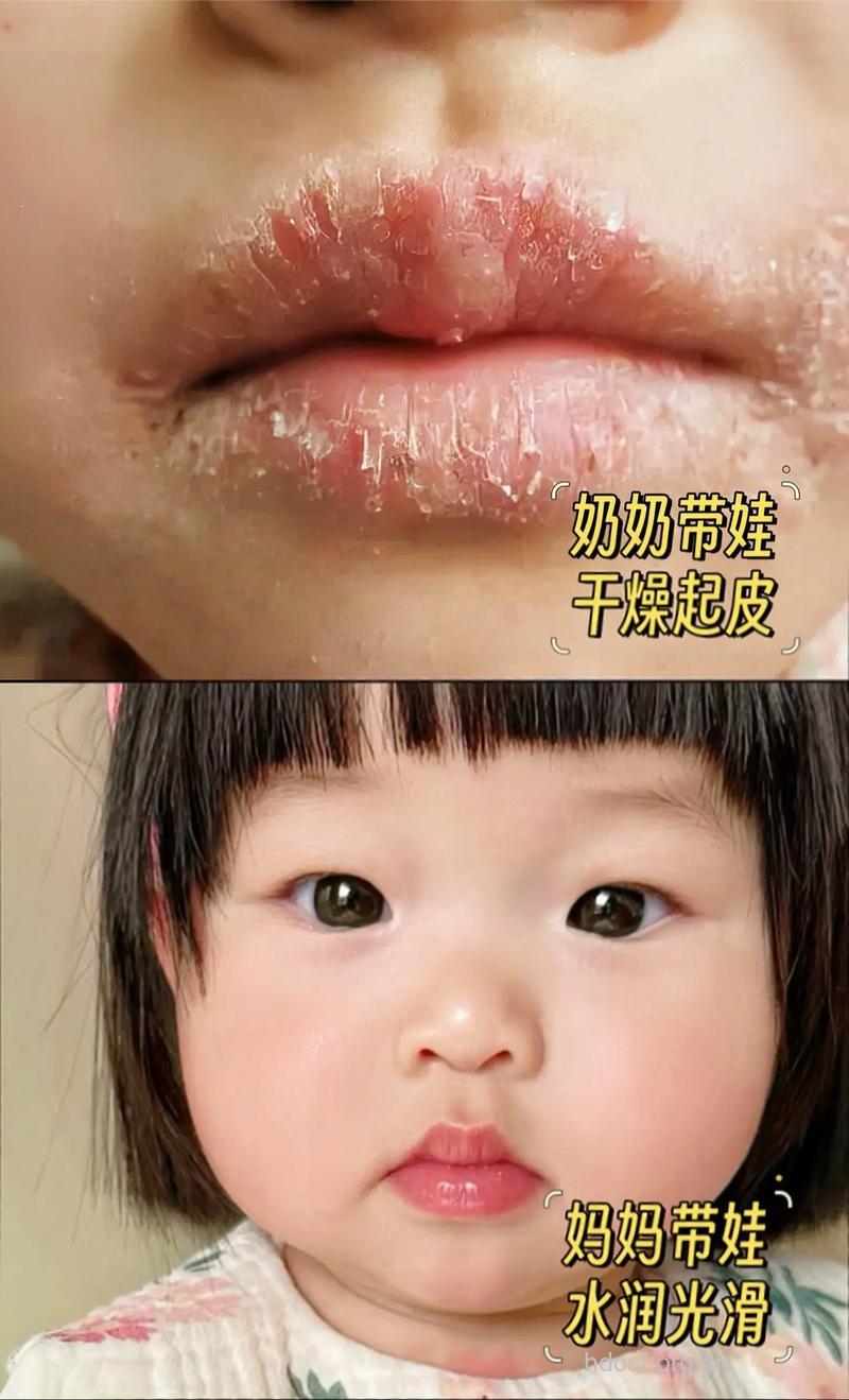 冬季唇部护理3个危险动作
