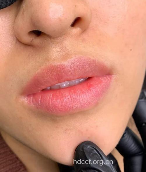 唇部去角质 还你迷人双唇