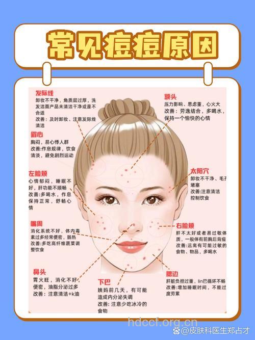 下巴长痘的原因是什么