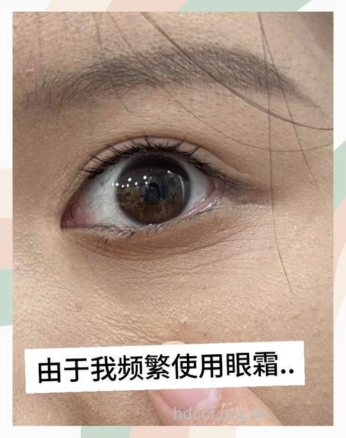 再不用眼霜你就真的老了