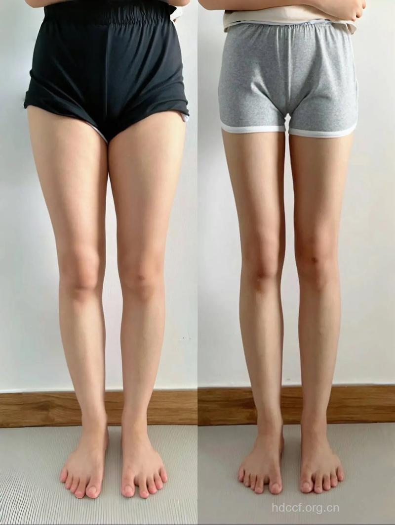 腿太细的人代谢差 你还敢瘦下去吗