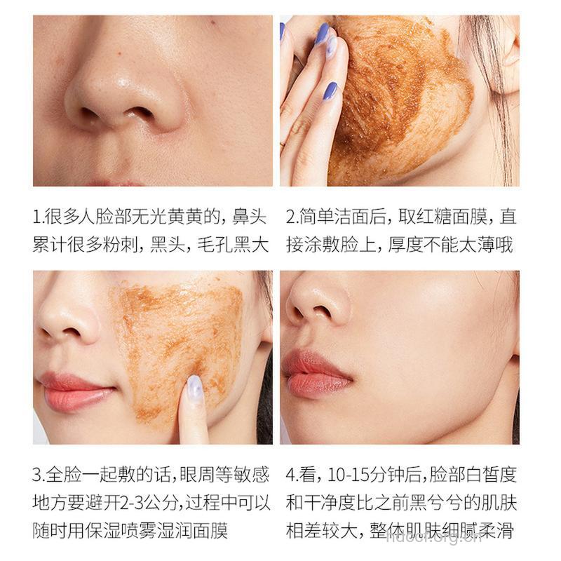 红糖加蜂蜜可以去黑头吗