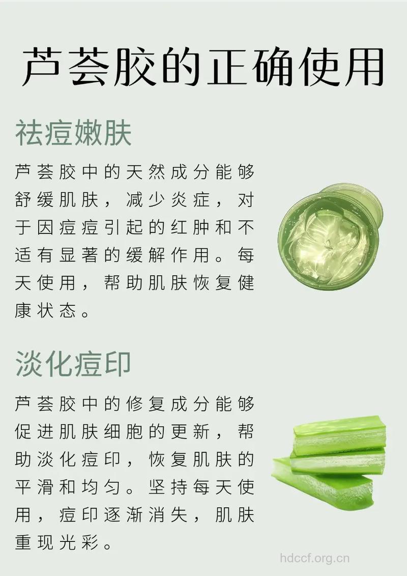 使用芦荟胶祛痘 你需要了解正确的方法