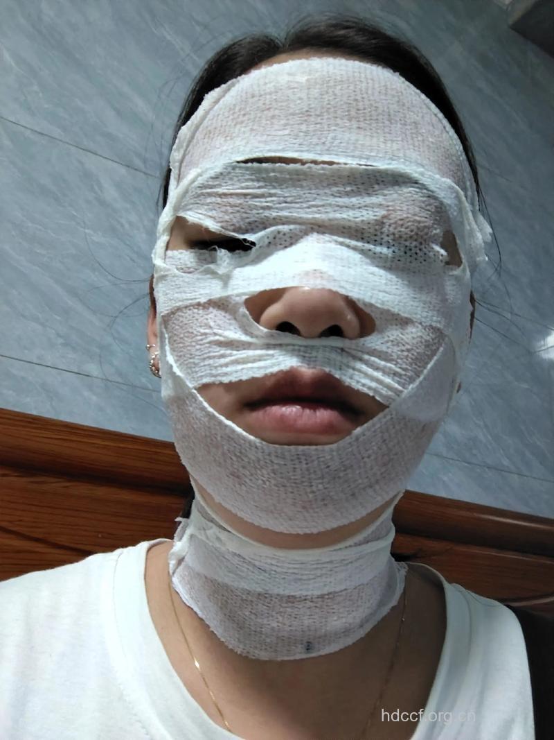 用牛奶敷脸1个月皮肤有惊喜