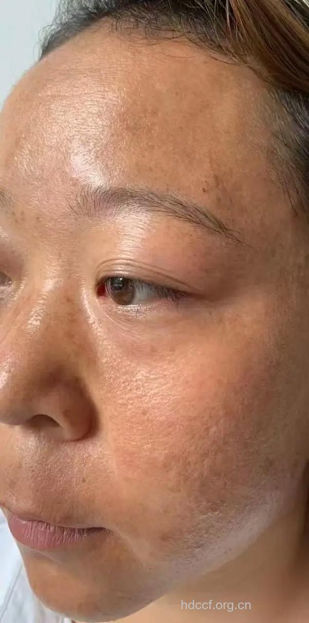 皮肤粗糙暗黄的罪魁祸首