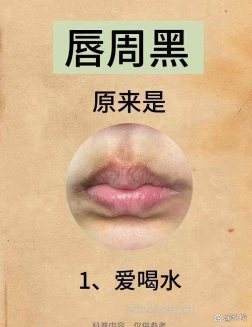 嘴角眼角皮肤暗沉发黑的原因