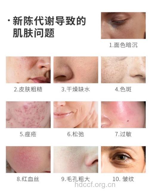 疾病引起的美容问题