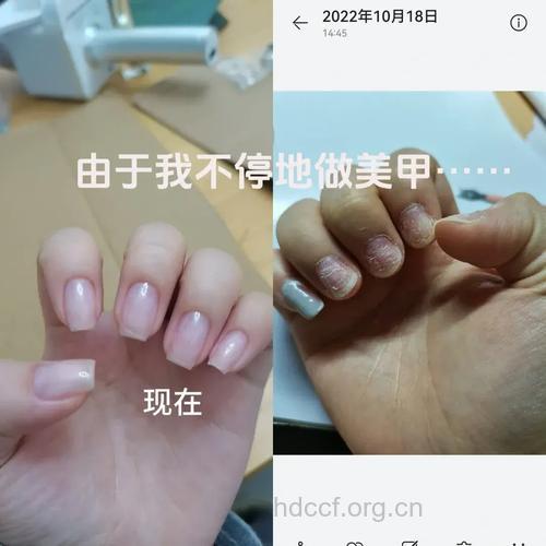 美丽负担 美甲的危害