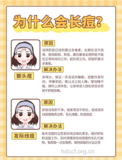 额头长痘的原因及祛痘方法