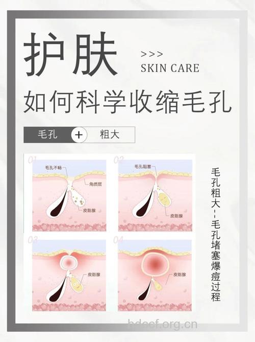 民间最为流行的收缩毛孔的妙招