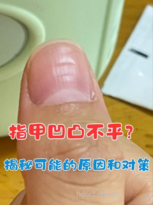 指甲表面凹凸不平的原因与解决方法