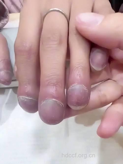 美甲也能导致癌症的发生