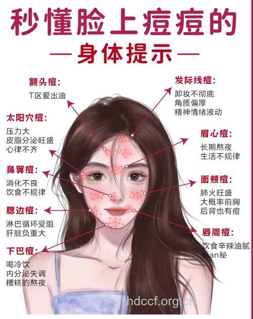 脸上各部位长痘原因
