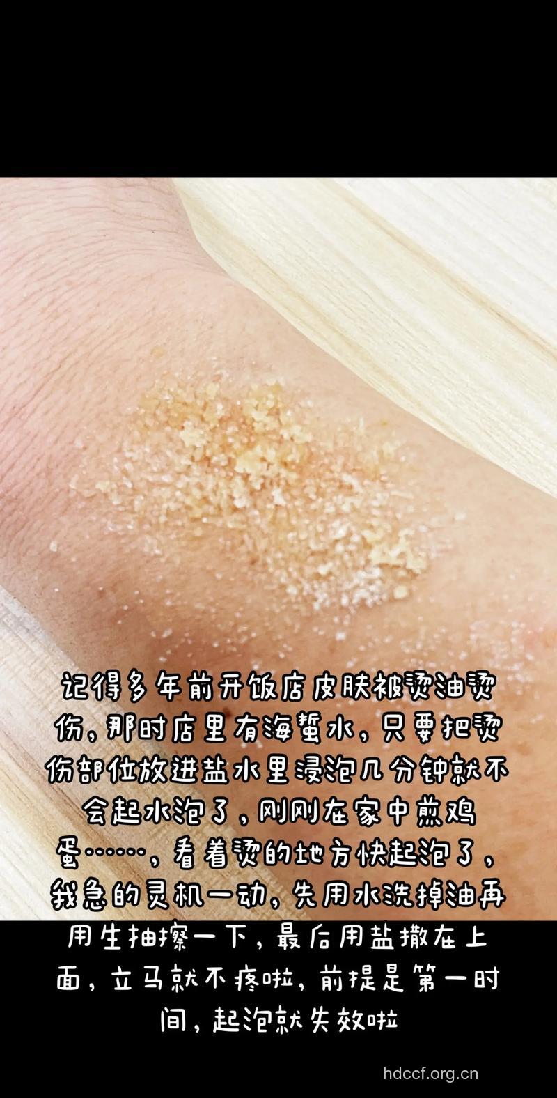 油盐吃多了对皮肤造成的伤害