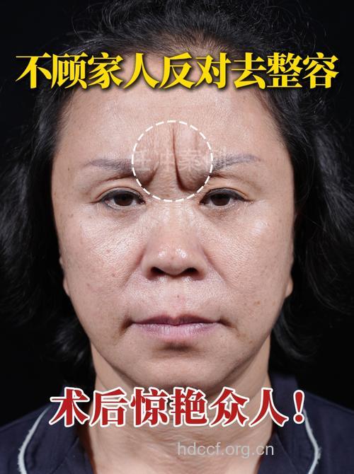 惊！脸上长皱纹竟因护发不当