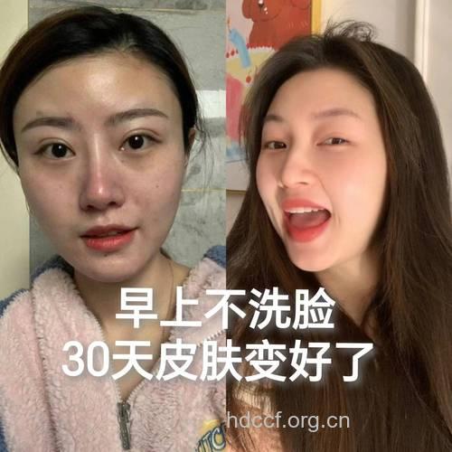 警惕!错误的洗脸观念会毁容