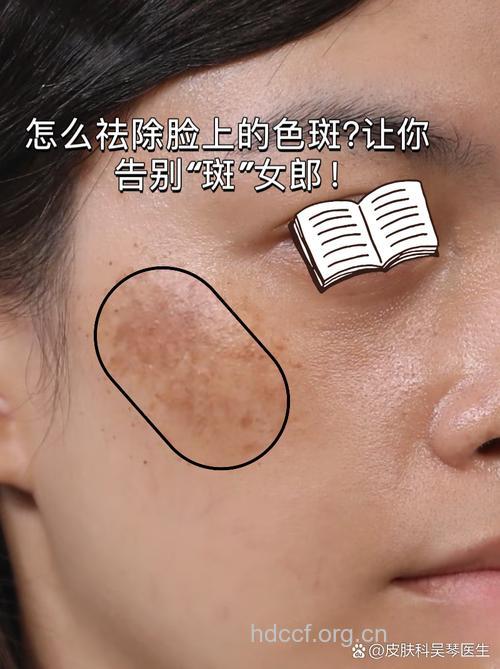 “彻底卸妆”让你长色斑？