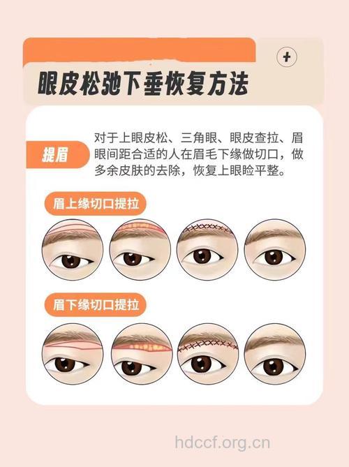 眼部皮肤松弛怎么办