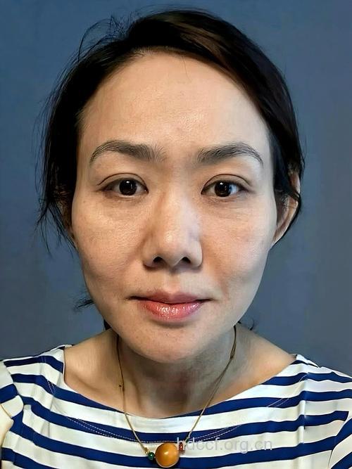跑步减肥 为何跑成了“黄脸婆”