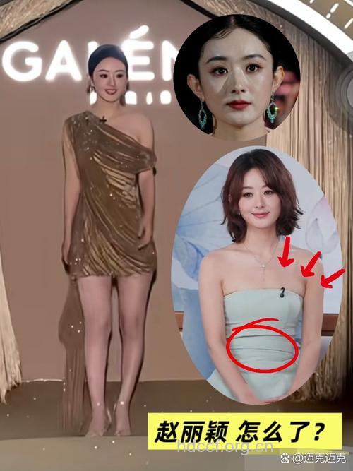 赵丽颖近照排骨胸抢镜 减肥如何不减胸