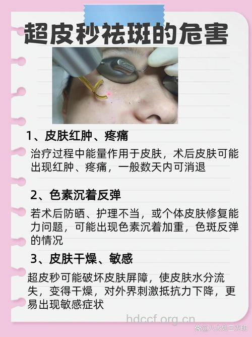 三种手术祛斑美白的伤害